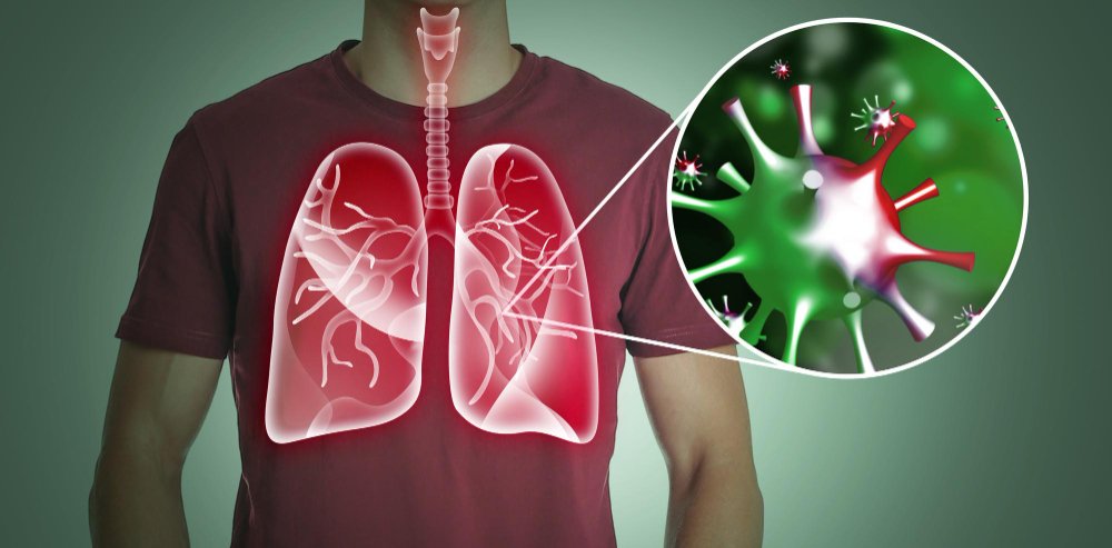  hombre con pulmones enfermos sobre fondo oscuro